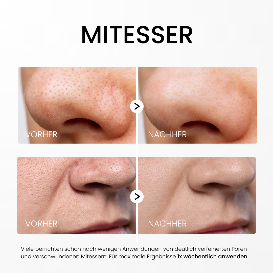 Rice Peel Glow Serum